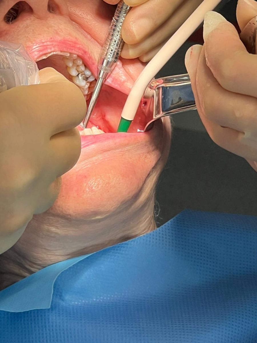 Implant surgery in progress